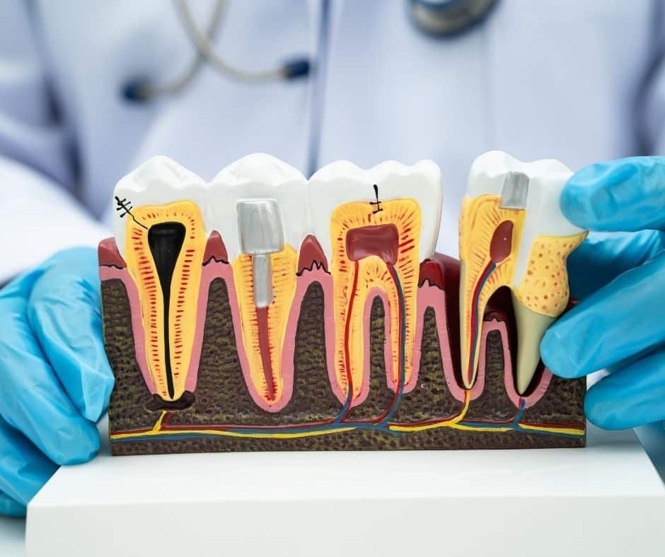 Dental Implant At 32 Smile Design Dental Implant at 32 Smile Design